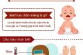 Thông điệp truyền thông phòng, chống bệnh tay chân miệng